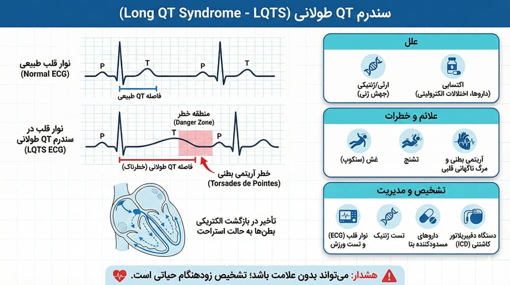 نوار قلب غیر نرمال