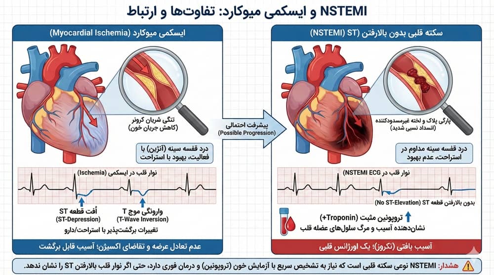 نوار قلب مشکل دار چگونه است
