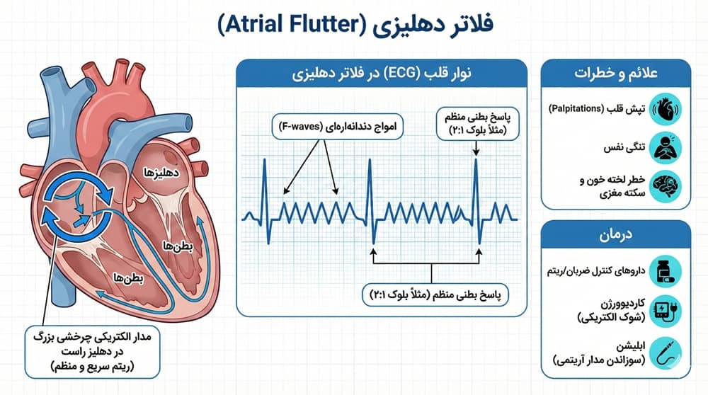 عکس نوار قلب بیمار