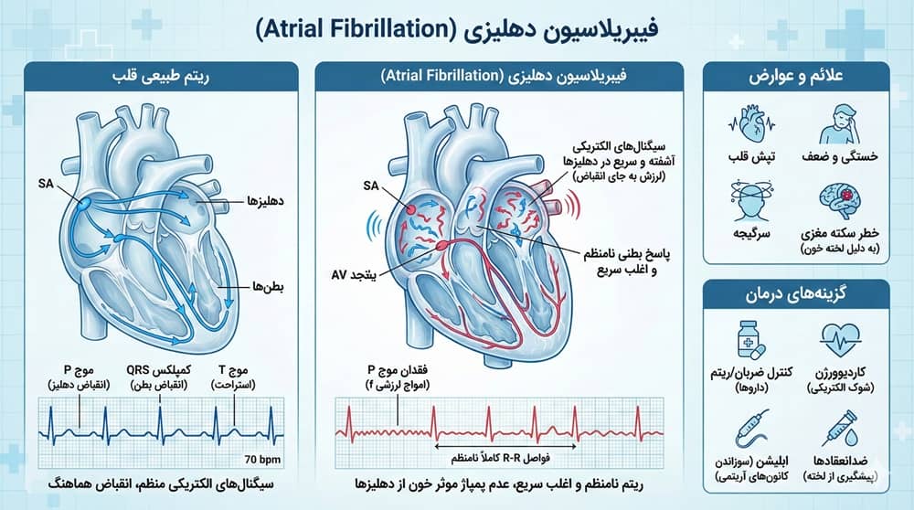 عکس نوار قلب فیبریلاسیون دهلیزی