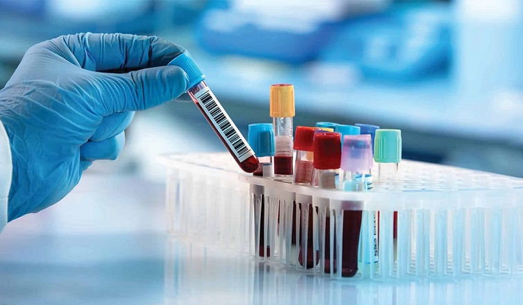 آزمایش چربی خون و تفسیر آن