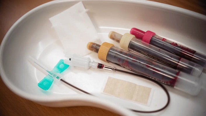 آزمایش چربی