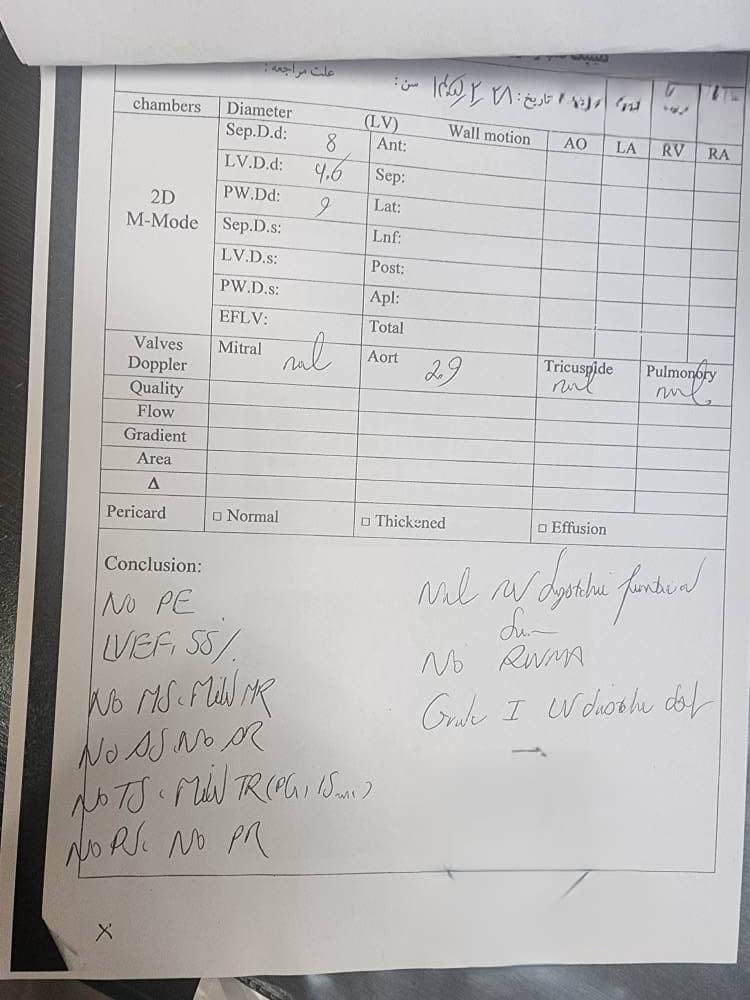 اکوی قلب نرمال